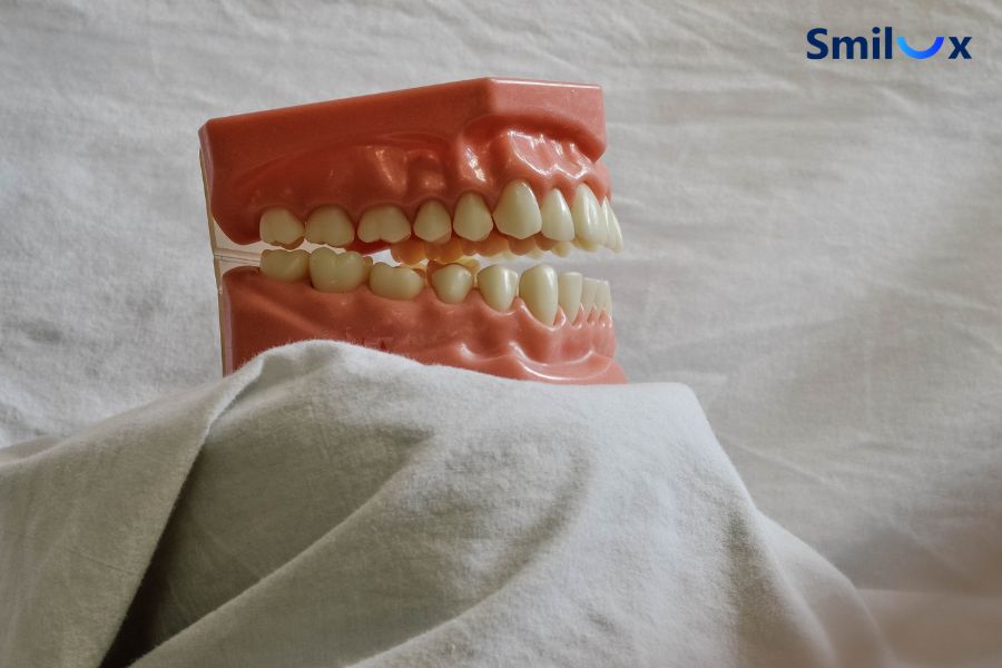 Có thể bọc răng sứ cho răng cửa bị hô nhẹ