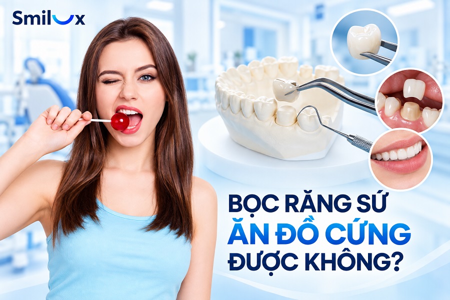 Bọc răng sứ có ăn đồ cứng được không? Bác sĩ Smilux giải đáp