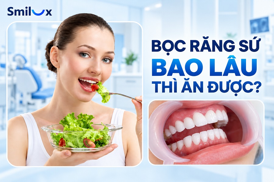 Bọc răng sứ bao lâu thì ăn được bình thường? Bác sĩ Smilux giải đáp