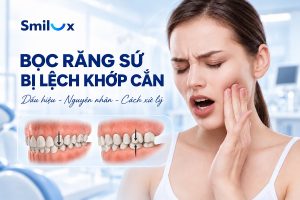 Bọc răng sứ bị lệch khớp cắn: Nguyên nhân và cách điều trị