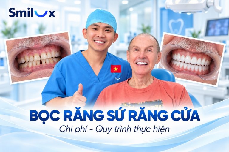 Bọc răng sứ răng cửa bao nhiêu tiền? Quy trình thực hiện thế nào?