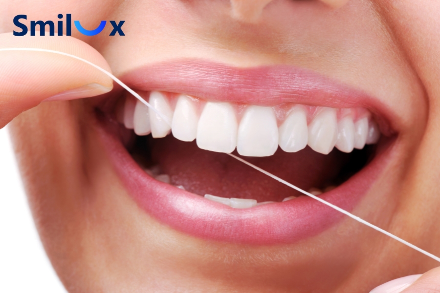 Sau khi cạo vôi răng, sử dụng chỉ nha khoa hằng ngày giúp làm sạch mảng bám và thức ăn thừa ở kẽ răng