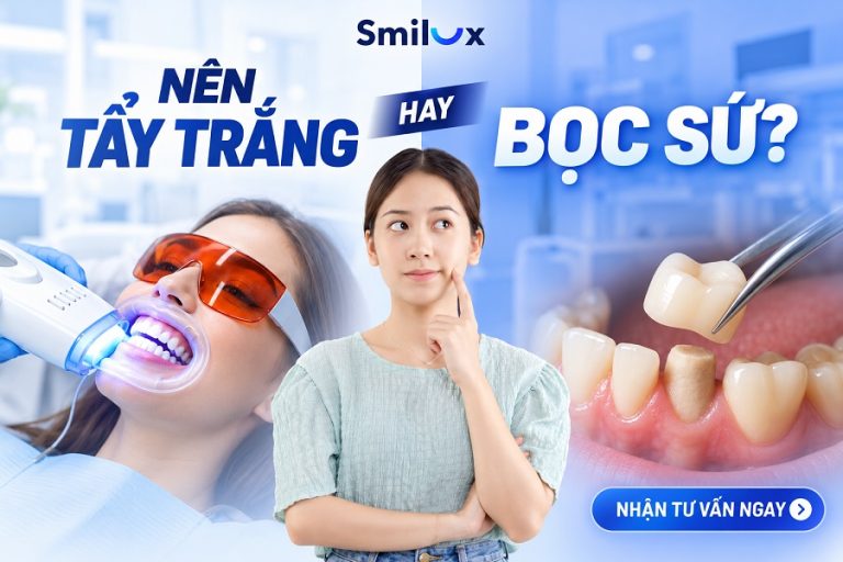 Nên tẩy trắng răng hay bọc sứ là tốt? Bác sĩ Smilux chia sẻ