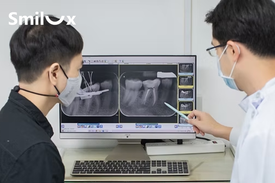 Nguyên tắc khi chữa tủy răng