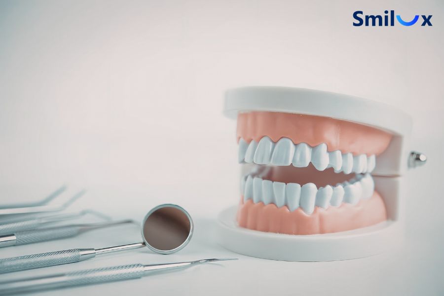 Chăm sóc răng miệng kỹ để duy trì độ bền của răng sứ