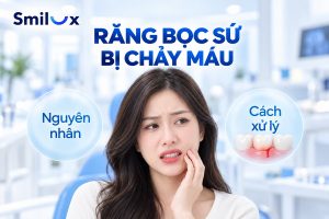 Răng bọc sứ bị chảy máu chân răng: Nguyên nhân và cách khắc phục