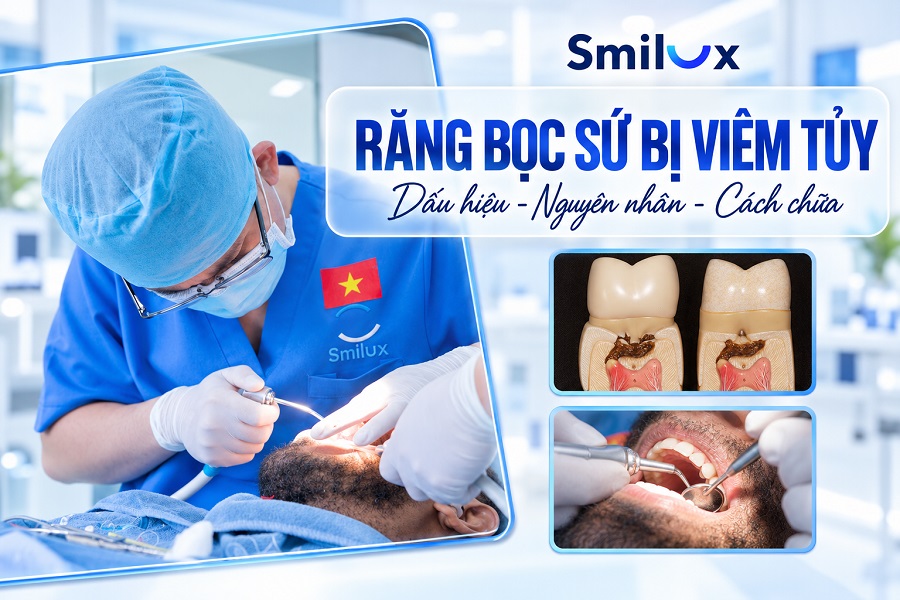 Tại sao răng bọc sứ bị viêm tủy? Dấu hiệu và cách chữa hiệu quả