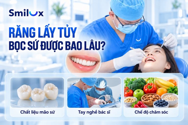 Răng lấy tủy bọc sứ được bao lâu? Các yếu tố ảnh hưởng