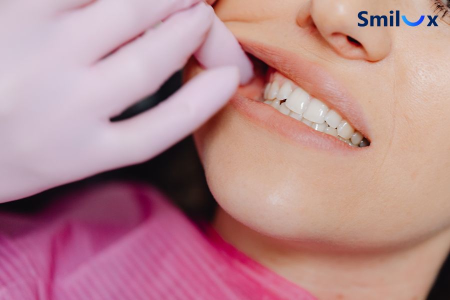 Thay răng sứ mới nếu răng sứ bị đen chân răng do lộ viền kim loại