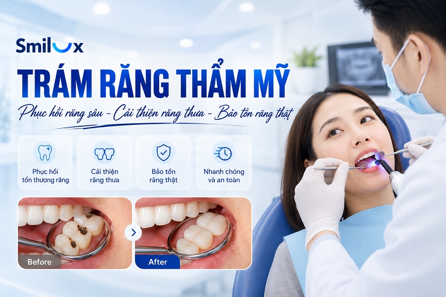 Trám răng là gì? Khi nào cần thực hiện? Chi phí và quy trình